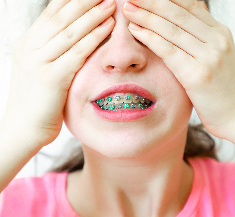 Traitement orthodontie chez l'enfant